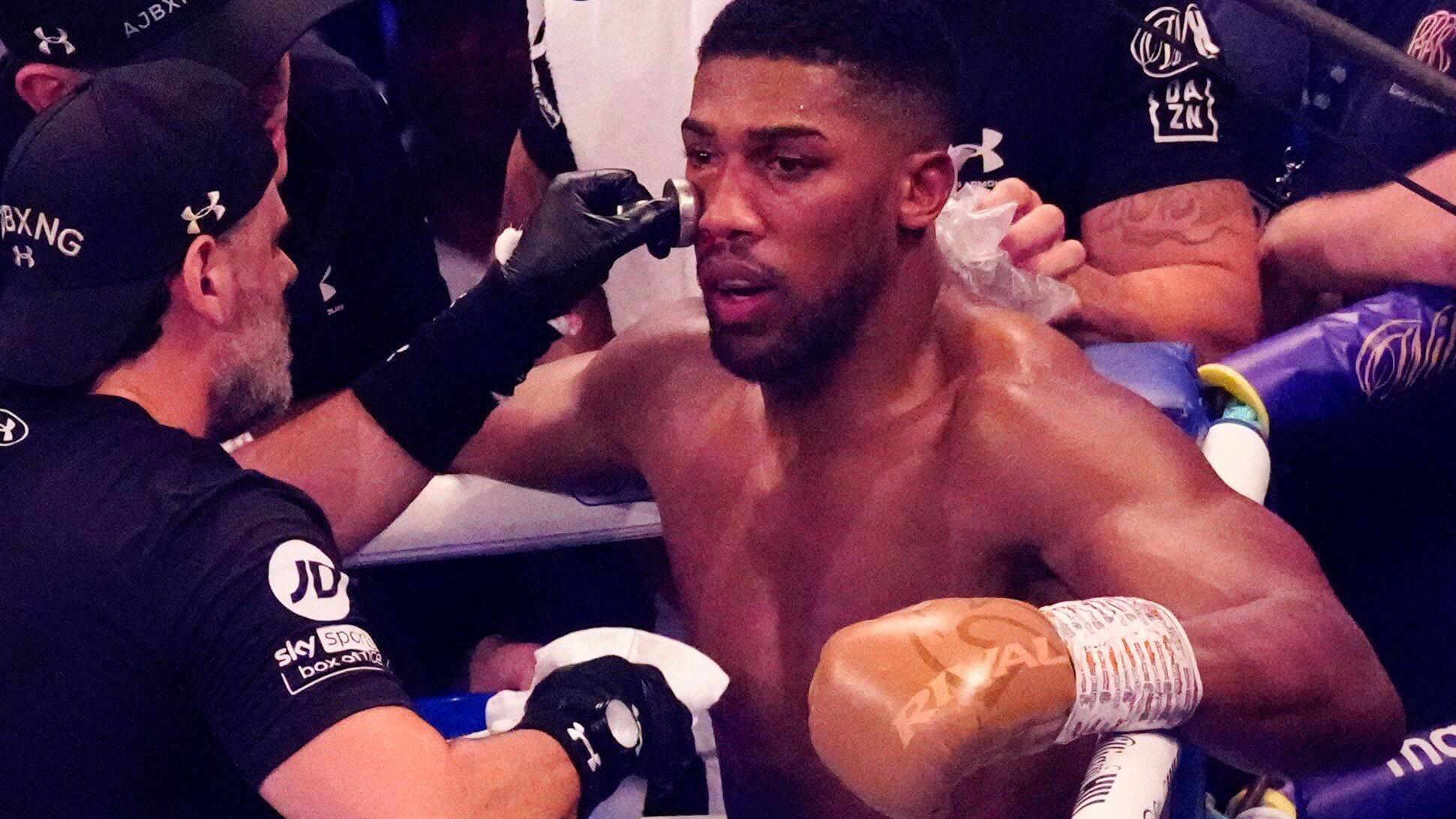 Boxing: Anthony Joshua looking for a coach