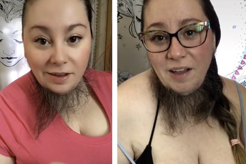 A woman receives dating requests after she proudly displays her beard on the net