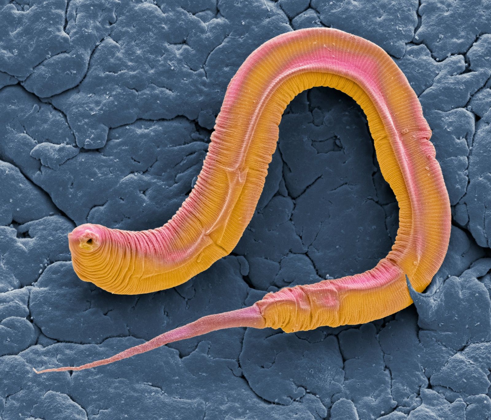 Hearing without an eardrum: a tiny worm that surprises science