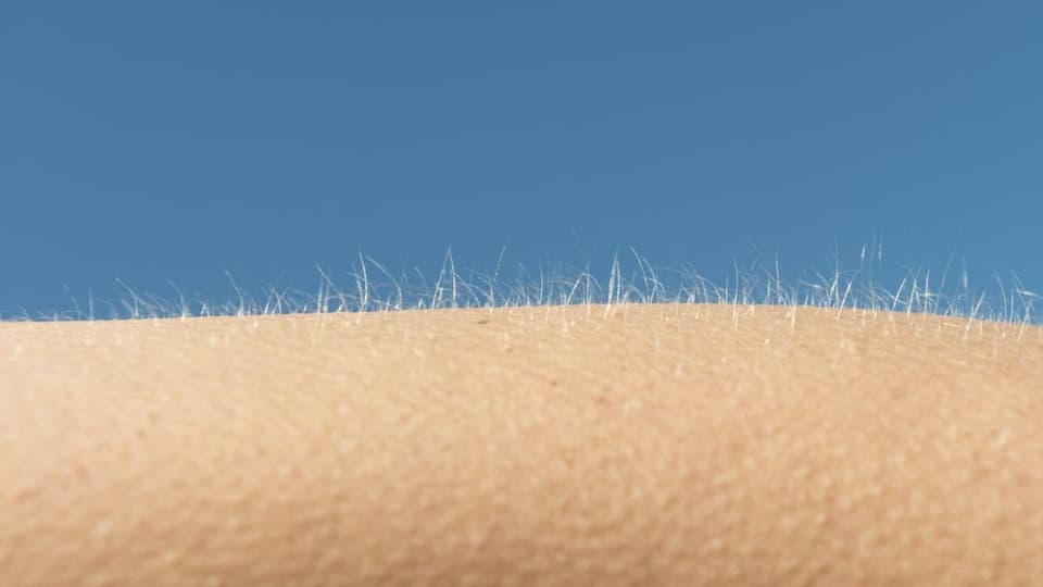 arm with goosebumps