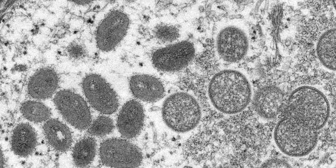 Monkeypox virus microscope